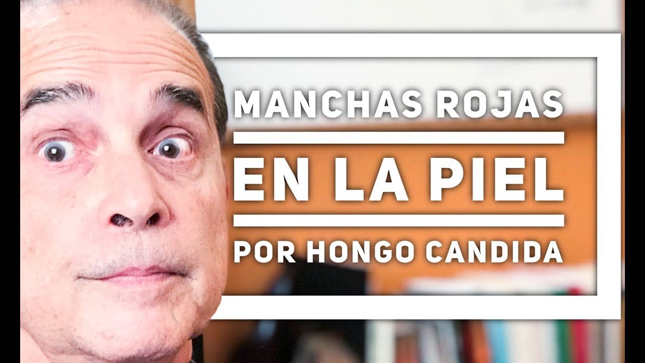 Precargar imagen